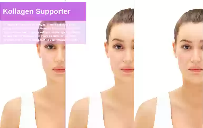 Kollagen Supporter (Replexium) Nedir? Güçlü Anti aging Etkisi ve Faydaları
